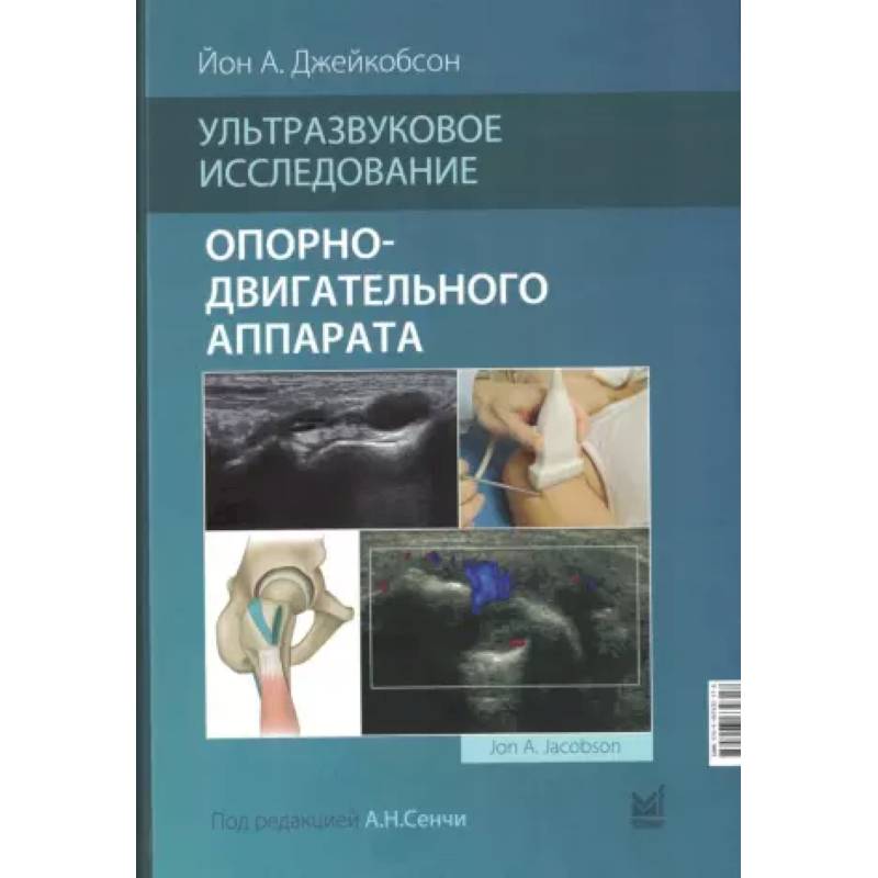 Ультразвуковое исследование опорно-двигательного аппарата