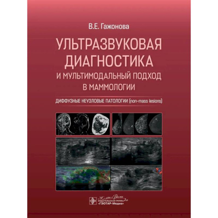 Медицинские энциклопедии и справочники, книга Ультразвуковая диагностика и мультимодальный подход в маммологии. Диффузные неузловые патологии купить по скидке