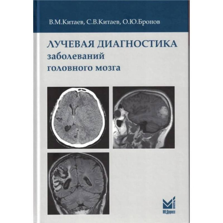 Другие виды специальной медицины, книга Лучевая диагностика заболеваний головного мозга купить по скидке