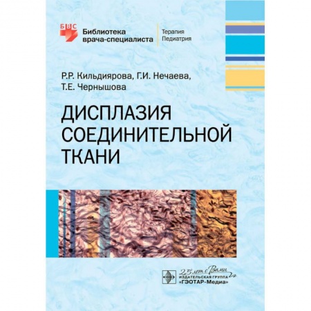 Медицина. Фармакология, книга Дисплазия соединительной ткани купить по скидке