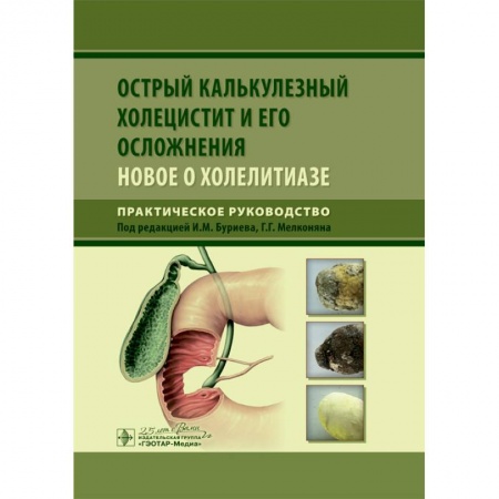 Хирургия. Ортопедия, книга Острый калькулезный холецистит и его осложнения. Новое о холелитиазе купить по скидке